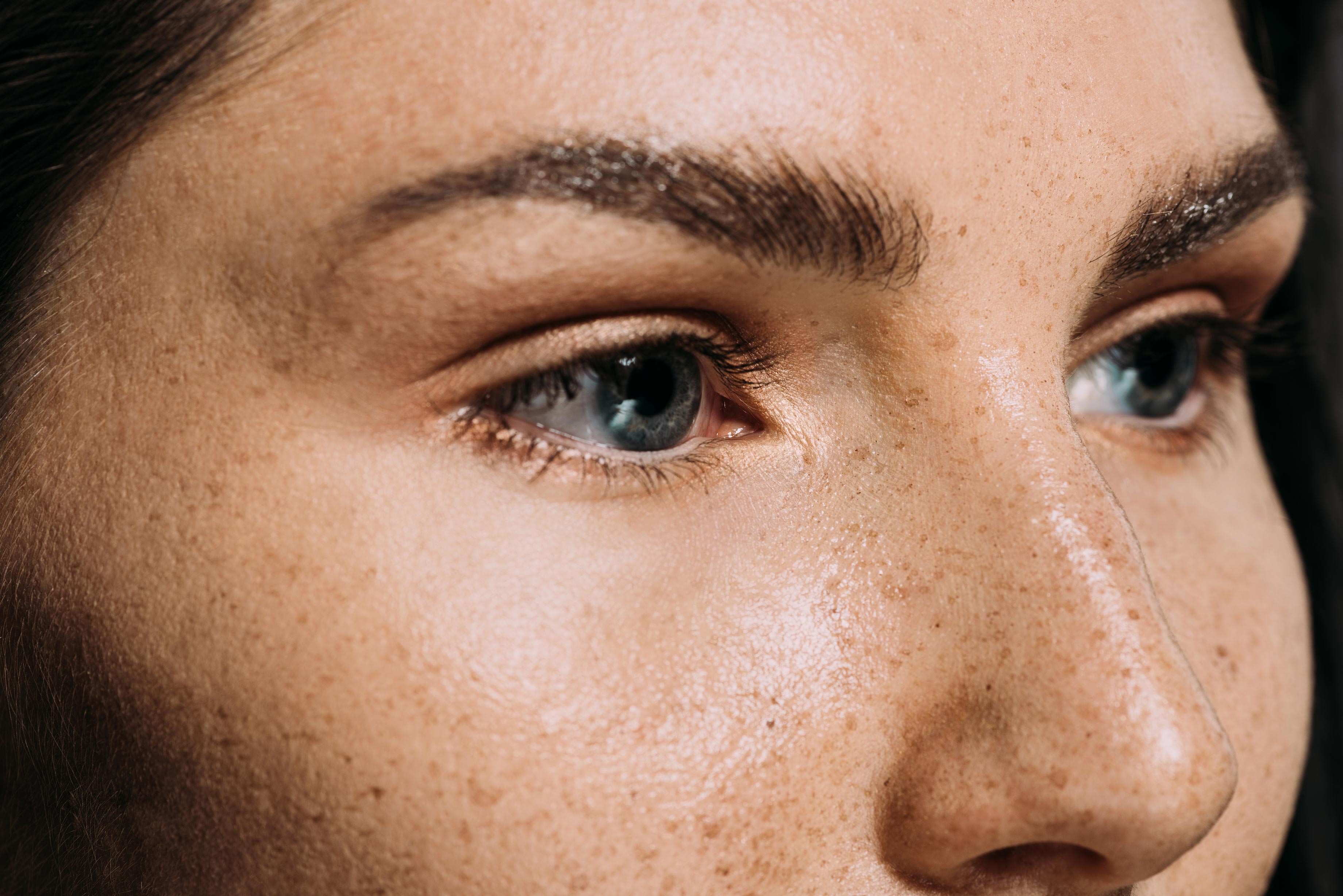 Does your skin have dark spots like this? - Skin Souffle